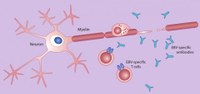 Celulele T în SM - progres în cercetare