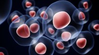 Tratamentul cu celule stem oprește SM progresivă